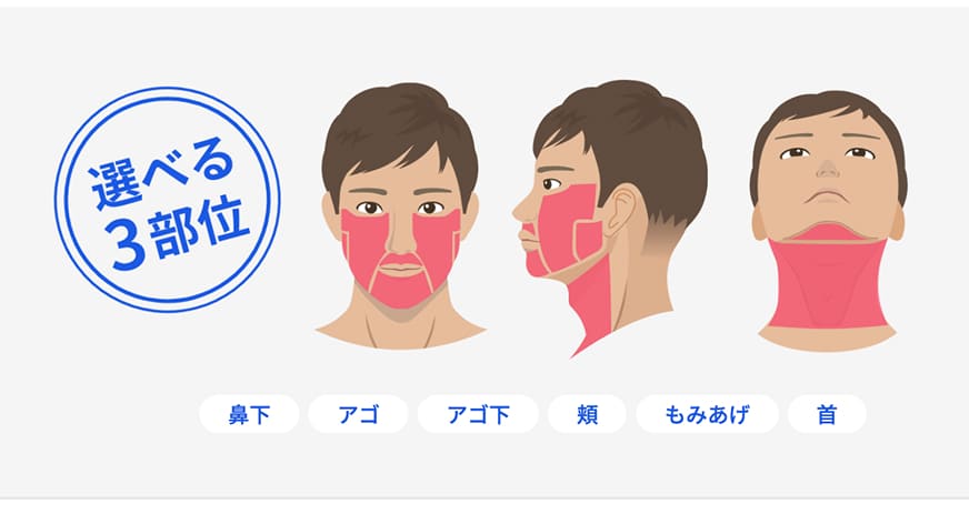選べる3部位の図