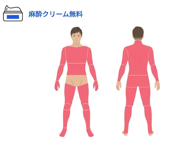 全身脱毛の図