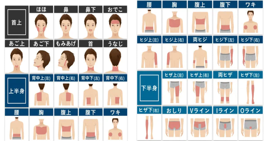 セレクト全身脱毛(10部位)の図